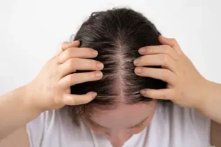 Say Goodbye to Bald Spots: The Natural Solution for Luxurious Hair!